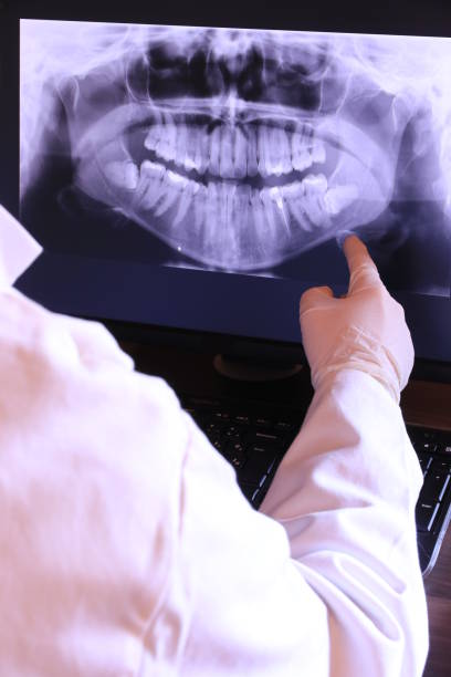 Best Emergency Treatment for Toothache in Jacksboro, TX